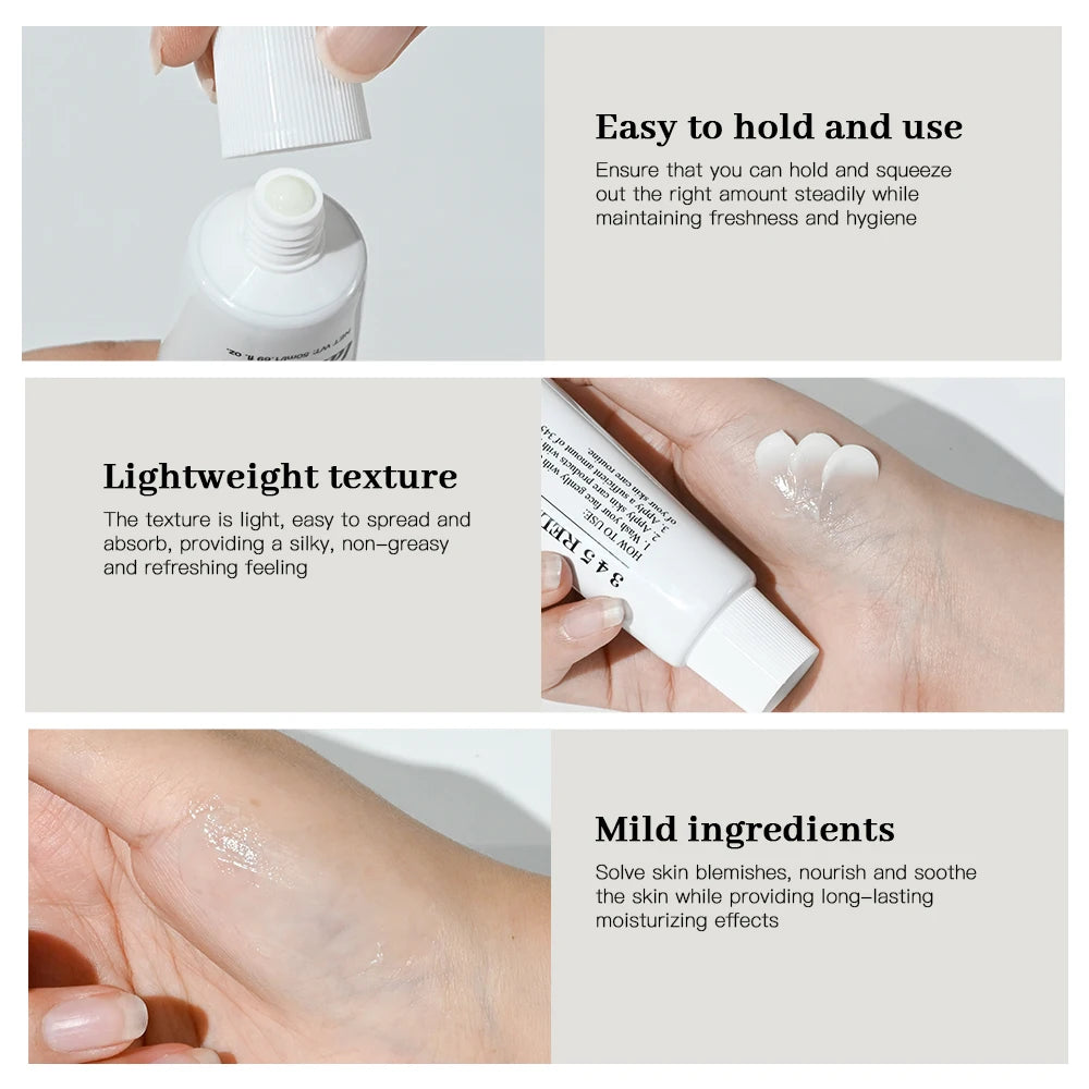 10% Azelaic Acid Cream - Rosacea Relief & Hyperpigmentation Corrector
