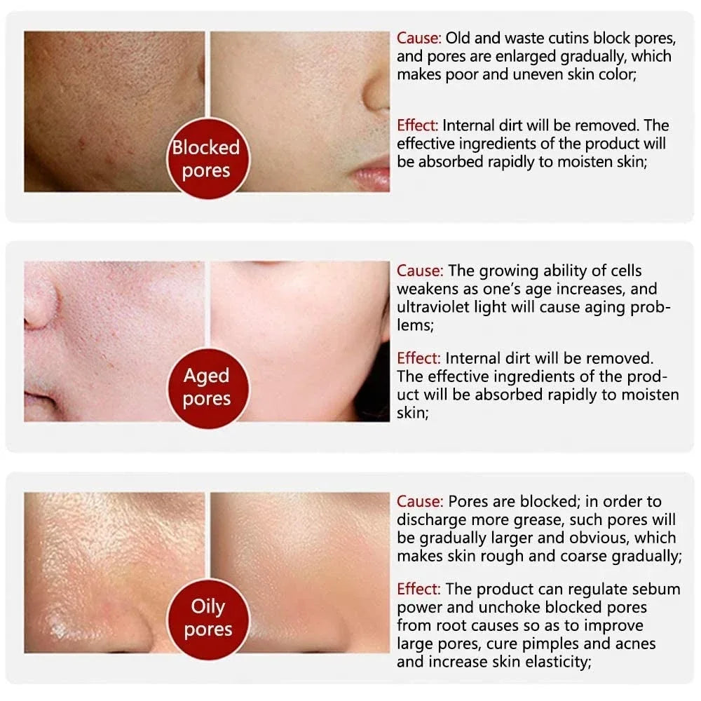 10% Niacinamide Serum - Pore Minimizer & Skin Tone Corrector