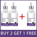 10% Niacinamide Serum - Pore Minimizer & Skin Tone Corrector
