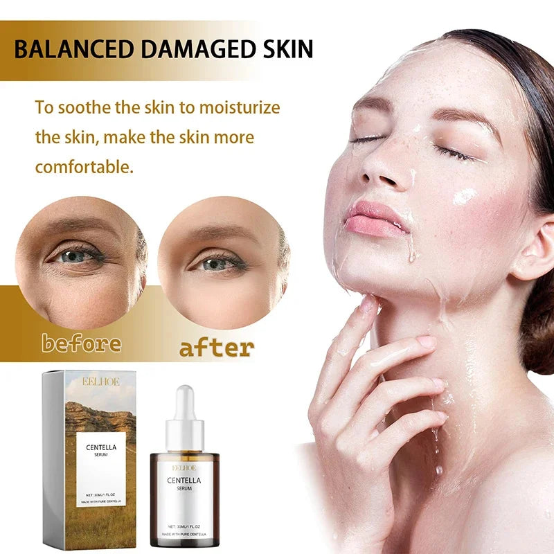 Calming Centella Asiatica Serum - Redness Relief & Sensitive Skin Therapy
