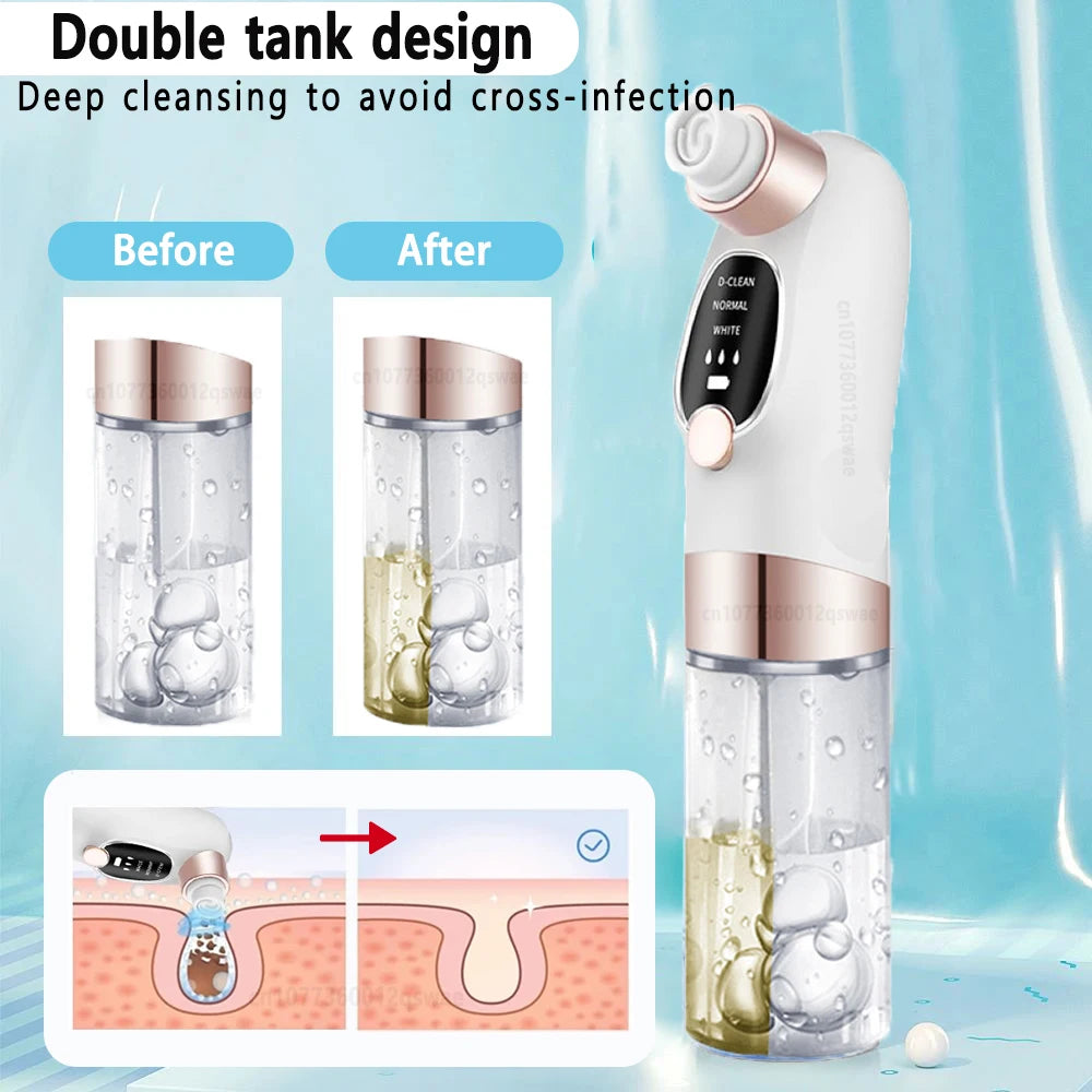 Pore Vacuum Blackhead Remover - Electric Suction Facial Clean Tool