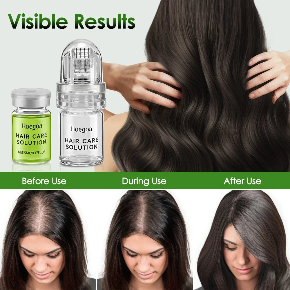 Ingrown Hair & Razor Bump Solution - After-Shave Exfoliating Liquid