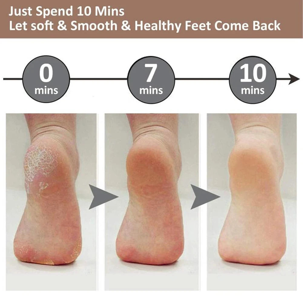 Rechargeable Electric Foot File - Callus Remover & Pedicure Tool