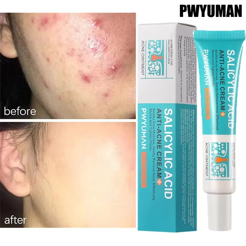 Clarifying Salicylic Acid Cleanser - Deep Acne & Pore Purifying Wash