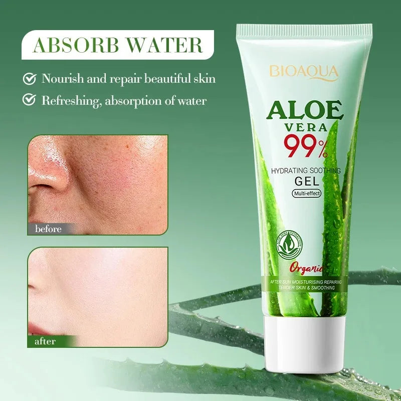 99% Pure Organic Aloe Vera Gel - After-Sun Soothing & Hydrating Gel