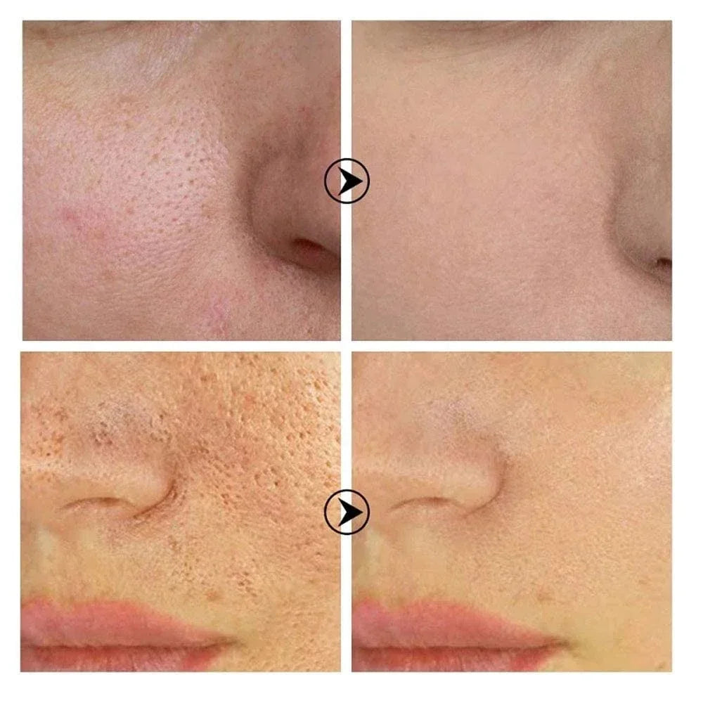 10% Niacinamide Serum - Pore Minimizer & Skin Tone Corrector