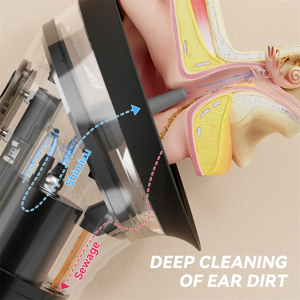 Safe Electric Ear Wax Removal Kit - Smart Vacuum Ear Cleaning Tool