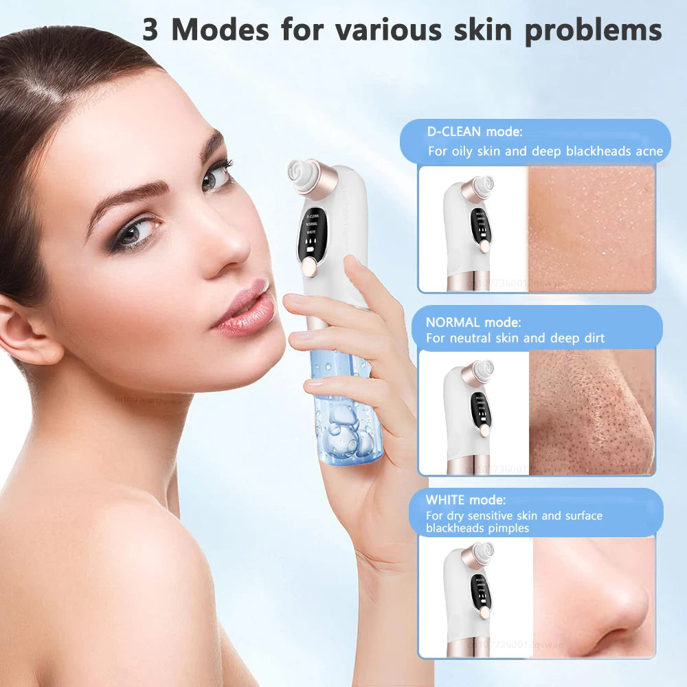 Pore Vacuum Blackhead Remover - Electric Suction Facial Clean Tool