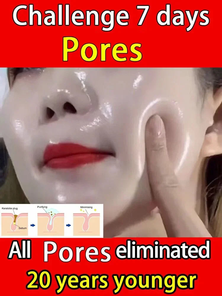 10% Niacinamide Serum - Pore Minimizer & Skin Tone Corrector