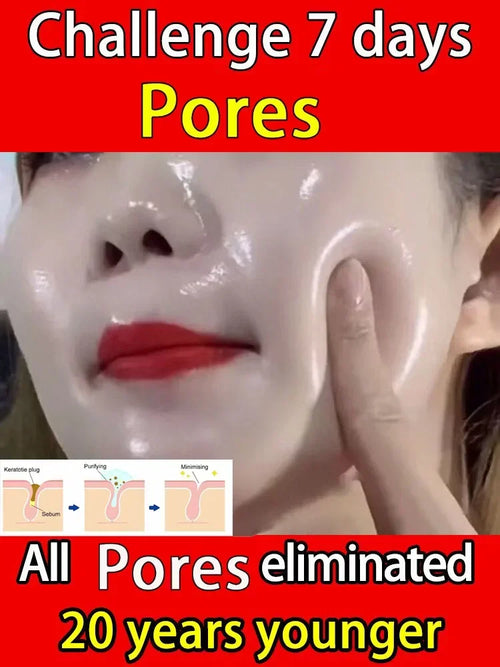 10% Niacinamide Serum - Pore Minimizer & Skin Tone Corrector