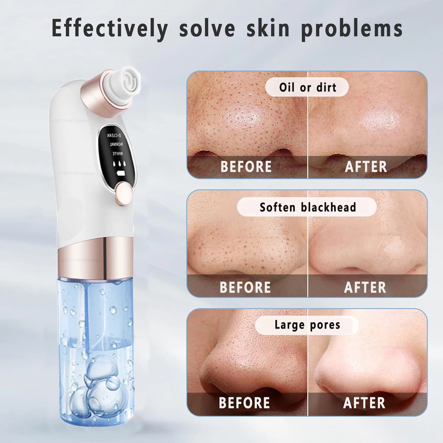 Pore Vacuum Blackhead Remover - Electric Suction Facial Clean Tool