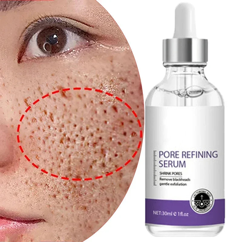 10% Niacinamide Serum - Pore Minimizer & Skin Tone Corrector