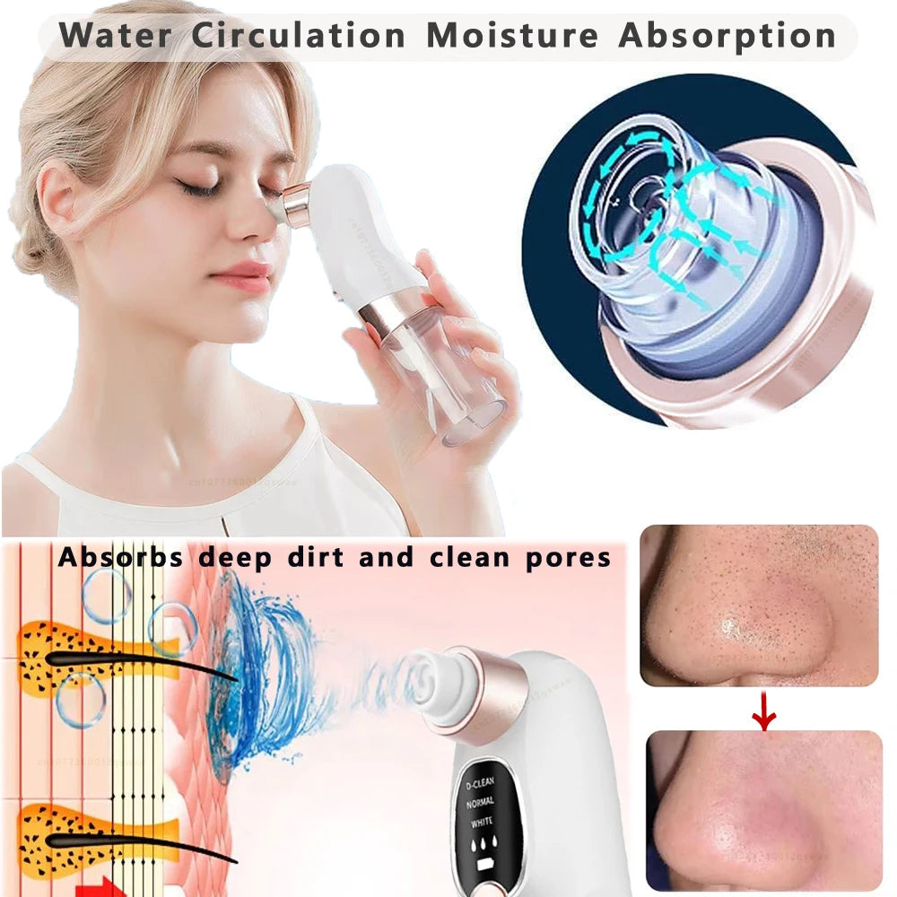 Pore Vacuum Blackhead Remover - Electric Suction Facial Clean Tool