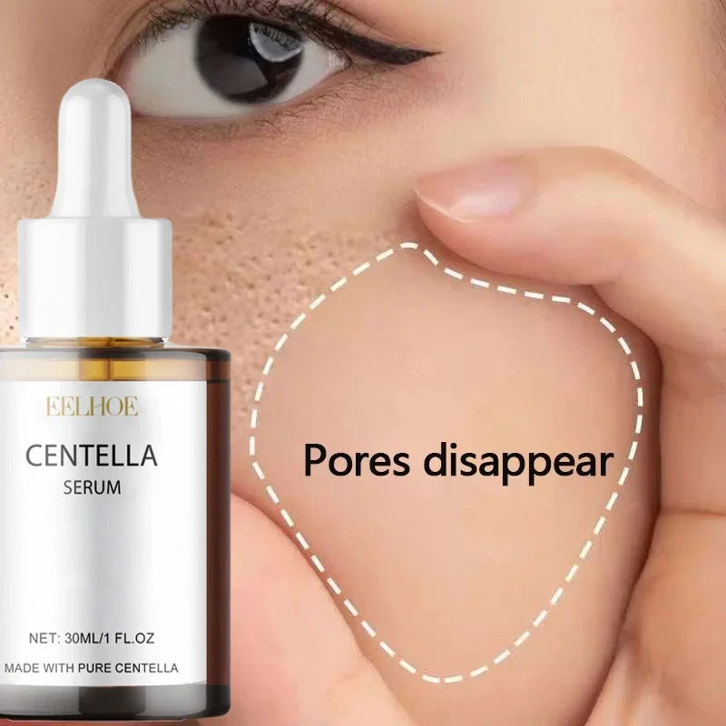 Calming Centella Asiatica Serum - Redness Relief & Sensitive Skin Therapy