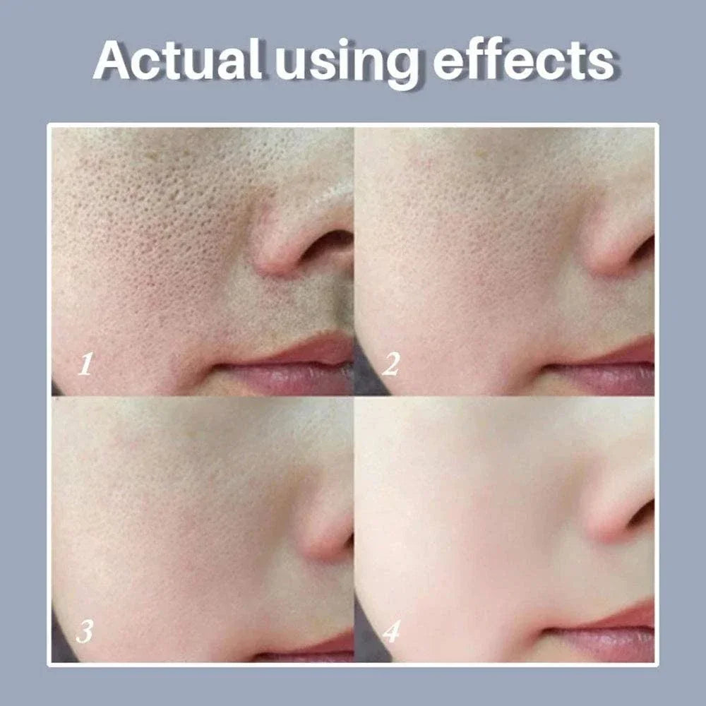 10% Niacinamide Serum - Pore Minimizer & Skin Tone Corrector