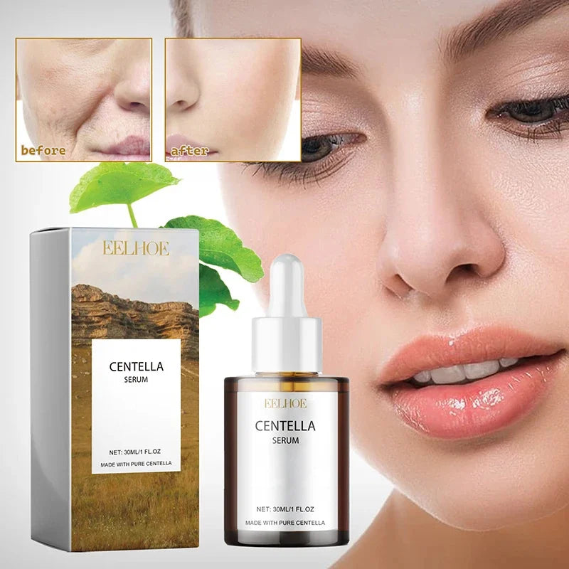 Calming Centella Asiatica Serum - Redness Relief & Sensitive Skin Therapy